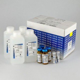 Набор реагентов Глюкоза-ВИТАЛ (гексокиназный метод)