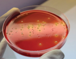Питательная среда для выделения и дифференциации патогенных энтеробактерий сухая (XLD-агар)